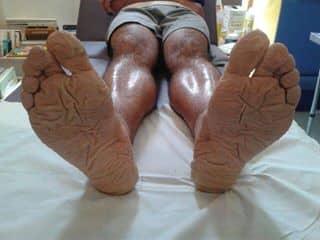 osteopathe-traitant-patient-debout-scaled