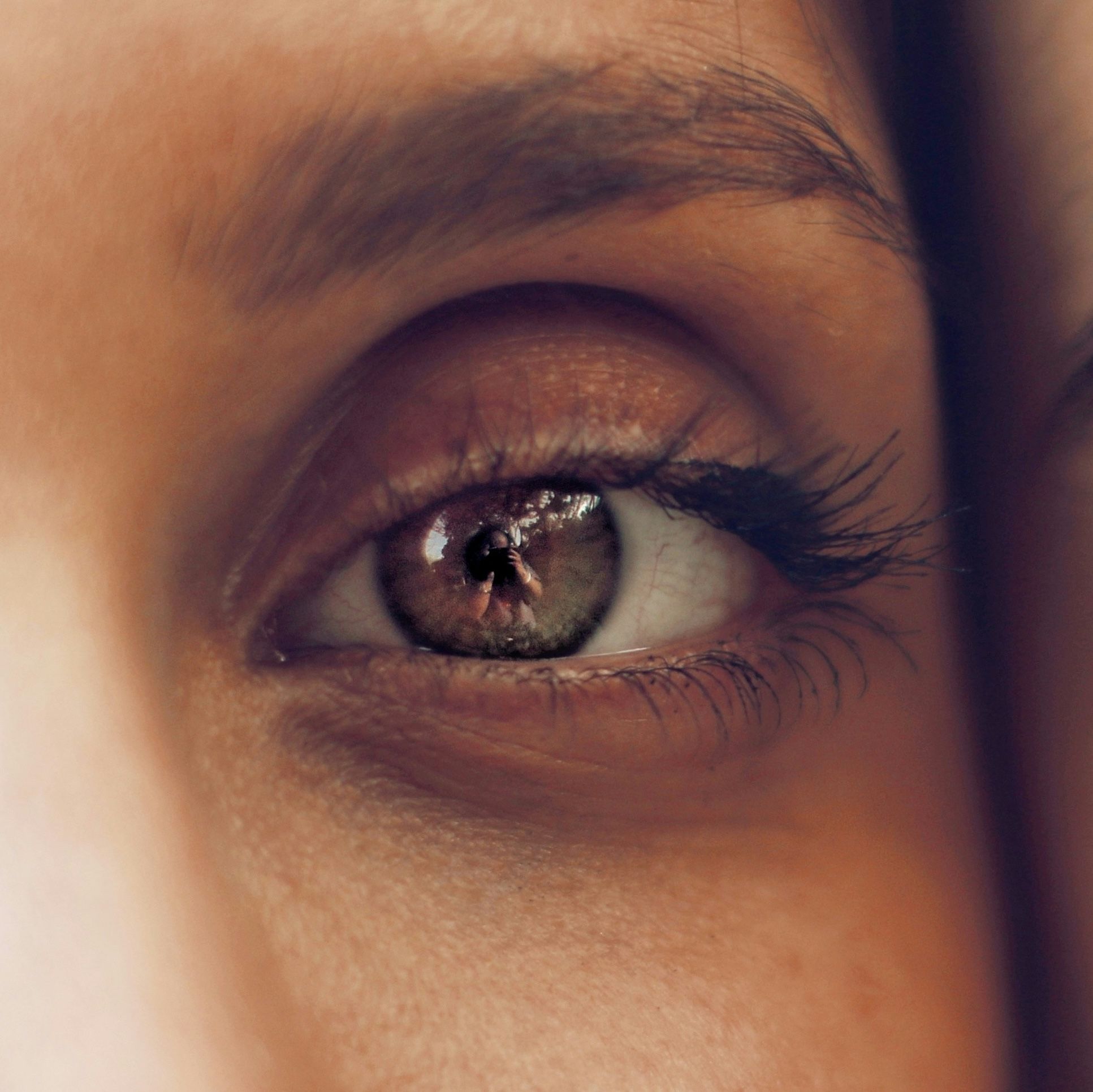 cernes astuces naturelles